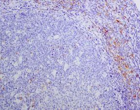 Immunohistochemistry (Formalin/PFA-fixed paraffin-embedded sections) - Anti-Human Kappa Chain antibody [EPR5539-71-8] - BSA and Azide free (AB211641)