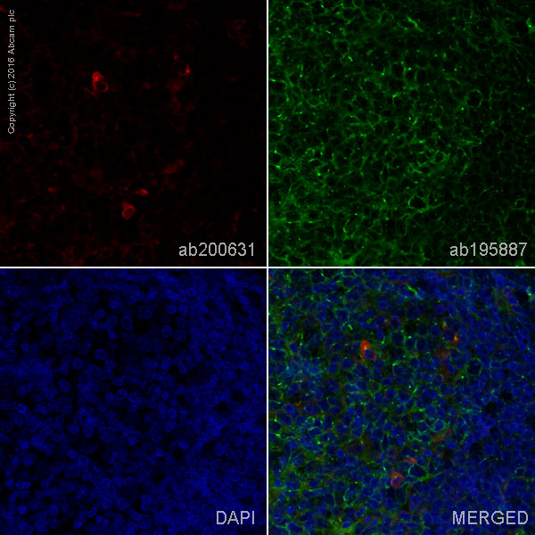 Immunohistochemistry (Formalin/PFA-fixed paraffin-embedded sections) - Anti-Human Kappa Chain antibody [EPR5539-71-8] - BSA and Azide free (AB211641)