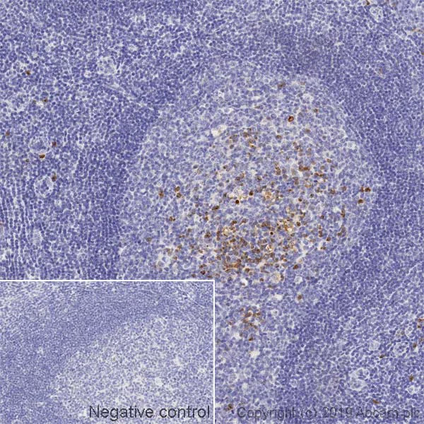 Immunohistochemistry (Formalin/PFA-fixed paraffin-embedded sections) - Anti-Human Kappa Chain antibody [TB-28] - BSA and Azide free (AB235128)
