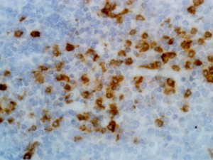 Immunohistochemistry (Formalin/PFA-fixed paraffin-embedded sections) - Anti-Human Kappa Light Chain antibody [RM126] (AB195576), expandable thumbnail