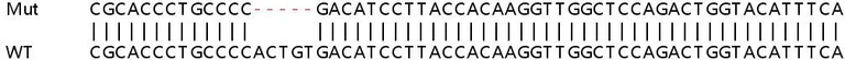 Sanger Sequencing - Human KDM5C (Jarid1C / SMCX) knockout HEK-293T cell line (AB266252)