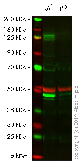 Western blot - Human KDM6A (UTX) knockout HeLa cell lysate (AB257214)