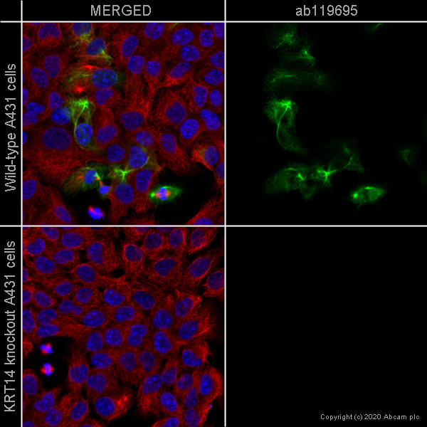 Immunocytochemistry/ Immunofluorescence - Human KRT14 (Cytokeratin 14) knockout A-431 cell line (ab261897), expandable thumbnail