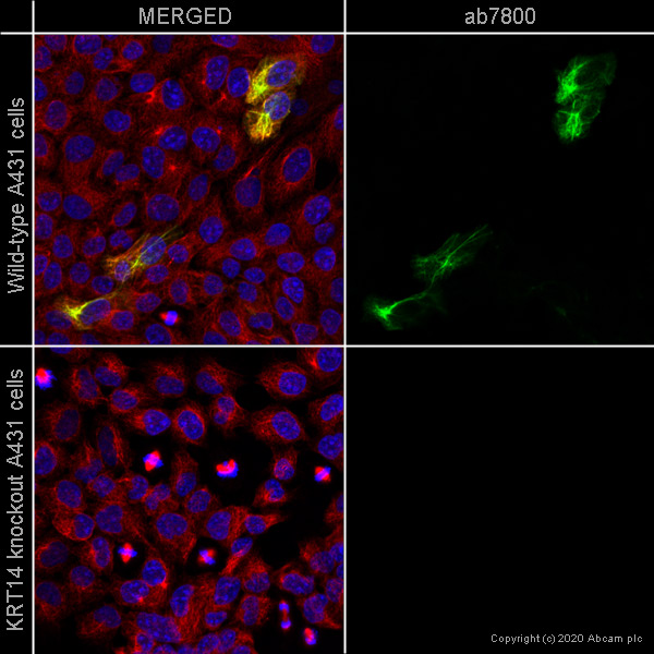 Immunocytochemistry/ Immunofluorescence - Human KRT14 (Cytokeratin 14) knockout A-431 cell line (ab261897), expandable thumbnail
