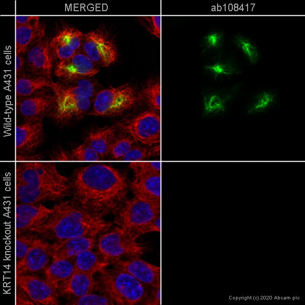Immunocytochemistry/ Immunofluorescence - Human KRT14 (Cytokeratin 14) knockout A-431 cell line (ab261897), expandable thumbnail