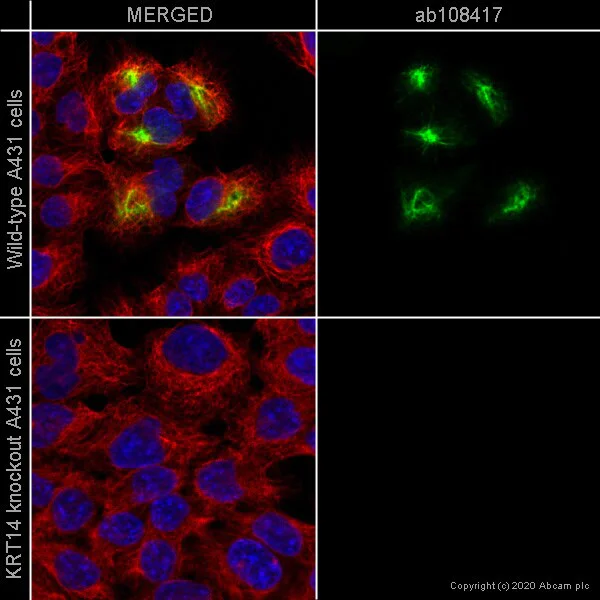 Immunocytochemistry/ Immunofluorescence - Human KRT14 (Cytokeratin 14) knockout A-431 cell line (AB261897)