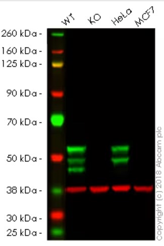 Western blot - Human KRT7 knockout A549 cell line (ab261867), expandable thumbnail