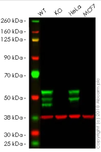 Western blot - Human KRT7 knockout A549 cell line (AB261867)