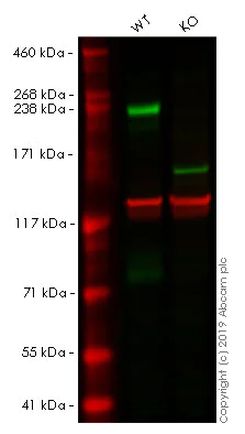 Western blot - Human L1CAM knockout HeLa cell lysate (AB263786)