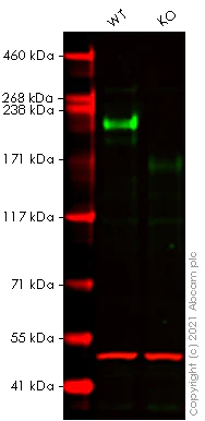 Western blot - Human L1CAM knockout HeLa cell lysate (AB273790)