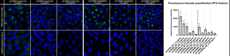Immunocytochemistry/ Immunofluorescence - Human LAMP2 knockout HeLa cell line (AB255402)