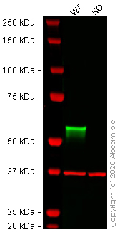 Western blot - Human LBR (Lamin B Receptor) knockout HEK-293T cell line (AB266308), expandable thumbnail
