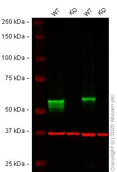 Western blot - Human LBR (Lamin B Receptor) knockout HEK-293T cell lysate (AB257503)