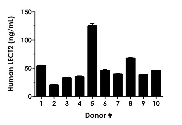 Sandwich ELISA - Human LECT2 ELISA Kit (AB269554)