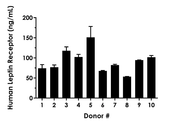 Sandwich ELISA - Human Leptin Receptor ELISA Kit (AB282876)