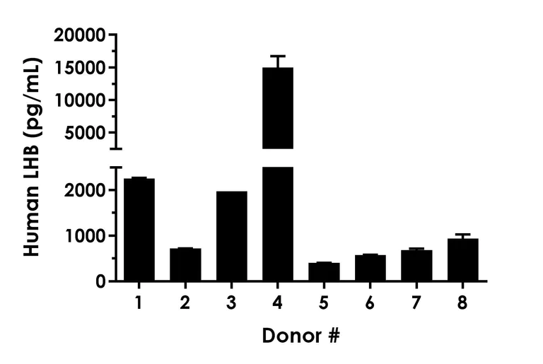Sandwich ELISA - Human LHB ELISA Kit (AB303746)