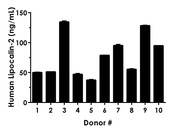 Sandwich ELISA - Human Lipocalin-2 ELISA Kit (AB215541)