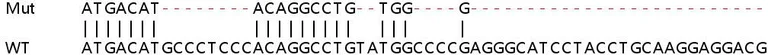 Sanger Sequencing - Human LMF2 knockout HeLa cell lysate (AB258945)