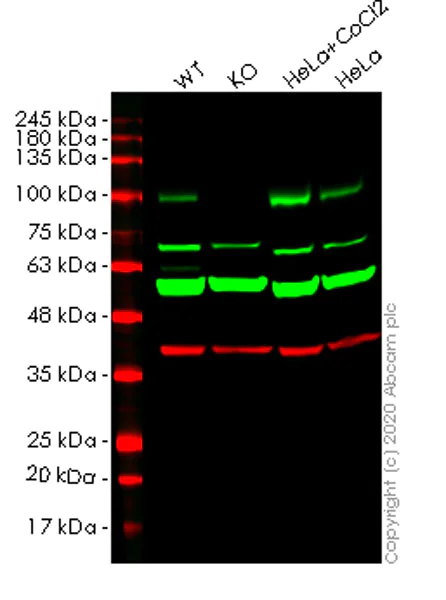 Western blot - Human LOXL2 knockout HeLa cell lysate (AB257168)
