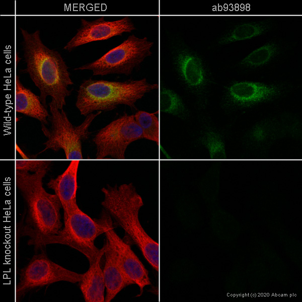 Immunocytochemistry/ Immunofluorescence - Human LPL (Lipoprotein lipase) knockout HeLa cell line (AB264016)