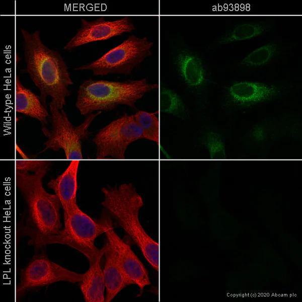 Immunocytochemistry/ Immunofluorescence - Human LPL (Lipoprotein lipase) knockout HeLa cell line (AB264016)