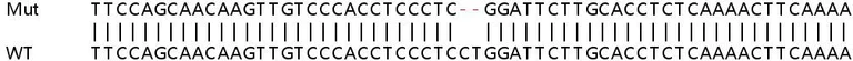 Sanger Sequencing - Human LRRK1 knockout HeLa cell line (AB264726)