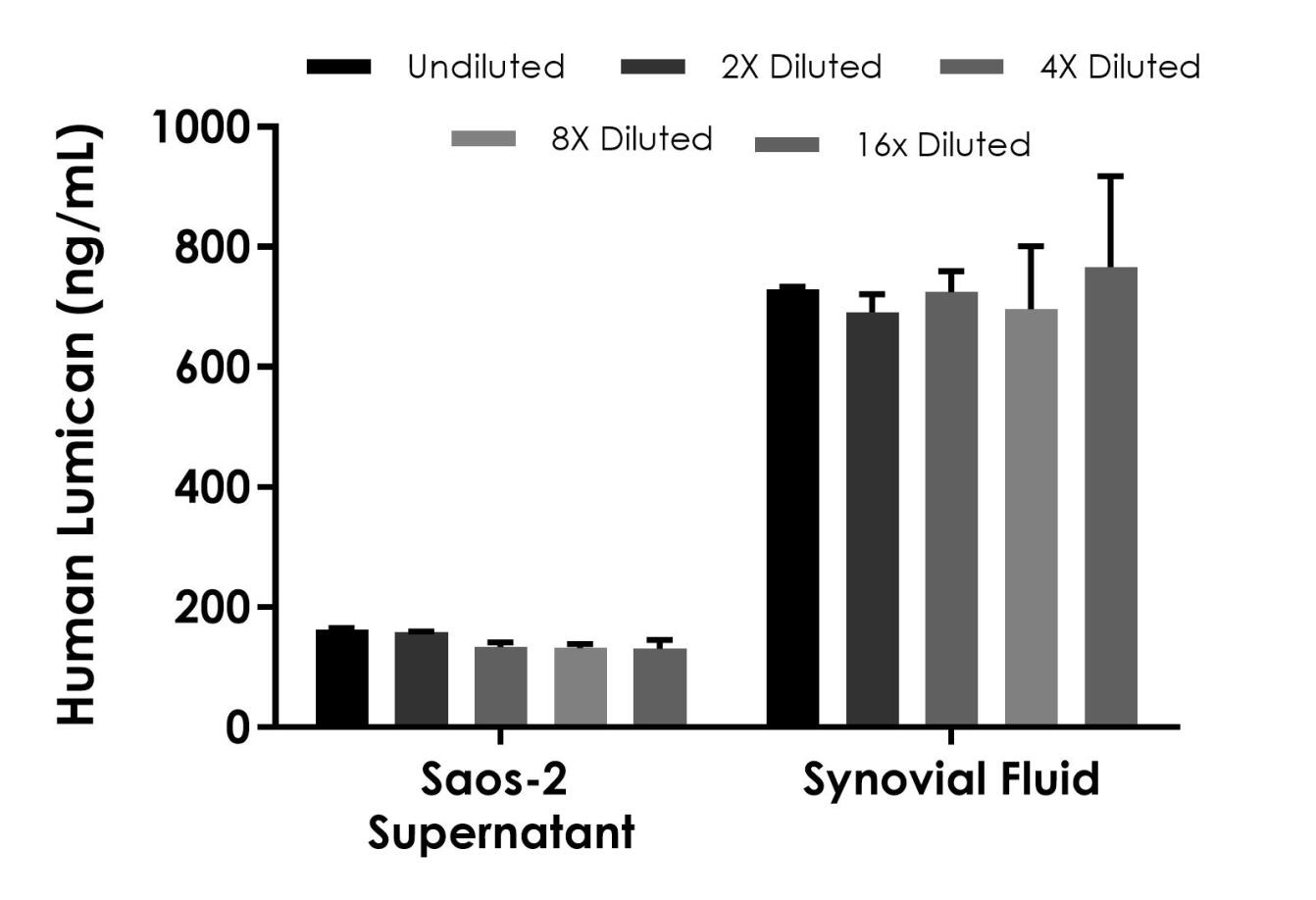 Sandwich ELISA - Human Lumican ELISA Kit (AB315054)