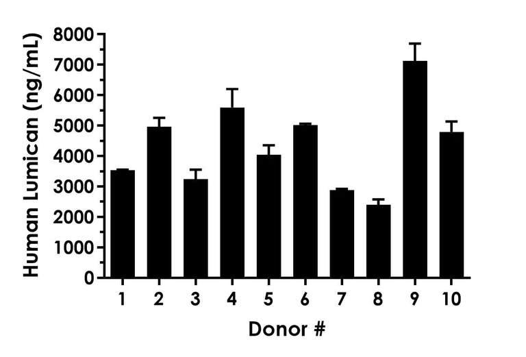 Sandwich ELISA - Human Lumican ELISA Kit (AB315054)