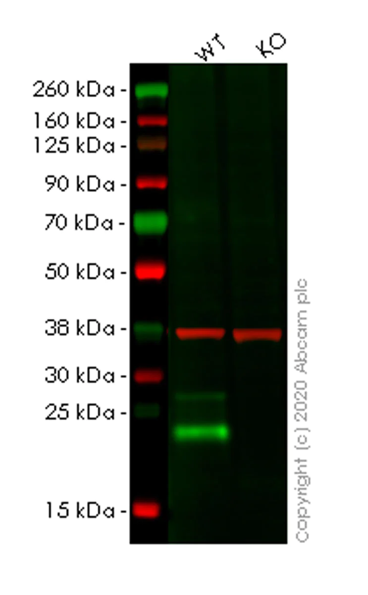 Western blot - Human LY6K (Ly-6K) knockout HeLa cell lysate (AB263248)