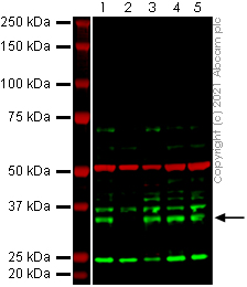 Human MAD2L1BP (CMT2) knockout HeLa cell line