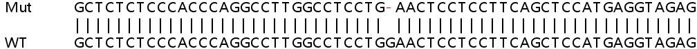 Human MAN1C1 (HMIC) knockout HeLa cell lysate