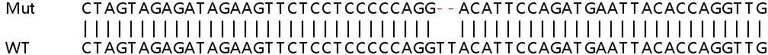 Sanger Sequencing - Human MAP3K2 (MEKK2) knockout A549 cell line (AB267152)