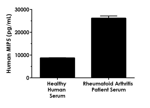 Sandwich ELISA - Human MIP5 ELISA Kit (ab217774), expandable thumbnail