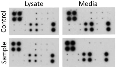 Dot Blot - Human MMP Antibody Array - Membrane (10 Targets) (AB134004)