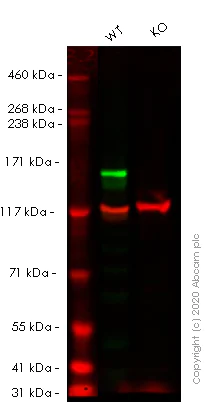 Western blot - Human MSH6 knockout HeLa cell line (AB255410)
