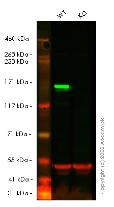 Western blot - Human MSH6 knockout HeLa cell line (AB255410)