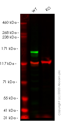 Western blot - Human MSH6 knockout HeLa cell lysate (AB263763), expandable thumbnail