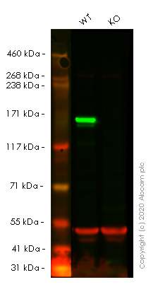 Western blot - Human MSH6 knockout HeLa cell lysate (AB263763), expandable thumbnail