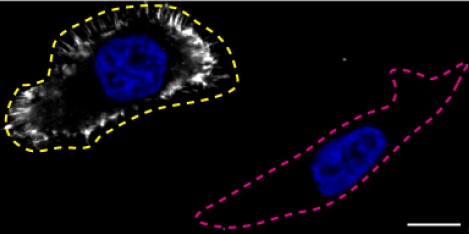 Immunocytochemistry - Human MSN (Moesin) knockout HeLa cell line (AB265020)