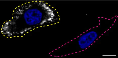 Immunocytochemistry - Human MSN (Moesin) knockout HeLa cell line (AB265020)