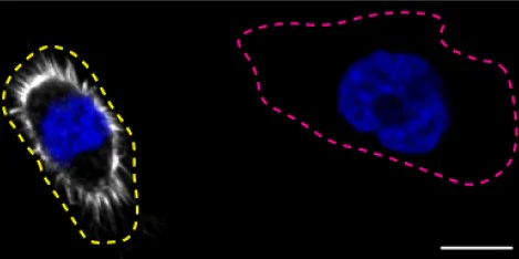 Immunocytochemistry/ Immunofluorescence - Human MSN (Moesin) knockout HeLa cell line (AB265020)