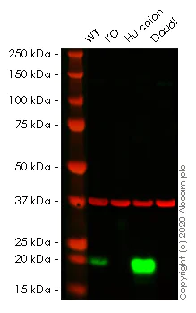 Western blot - Human MYL9 knockout HeLa cell line (AB266036)