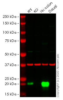 Western blot - Human MYL9 knockout HeLa cell line (AB266036), expandable thumbnail