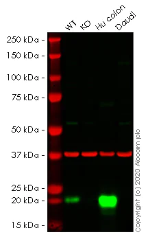 Western blot - Human MYL9 knockout HeLa cell line (AB266036)