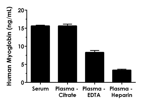 Sandwich ELISA - Human Myoglobin ELISA Kit (AB171580), expandable thumbnail