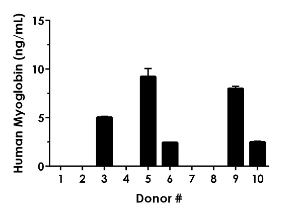 Sandwich ELISA - Human Myoglobin ELISA Kit (AB171580), expandable thumbnail