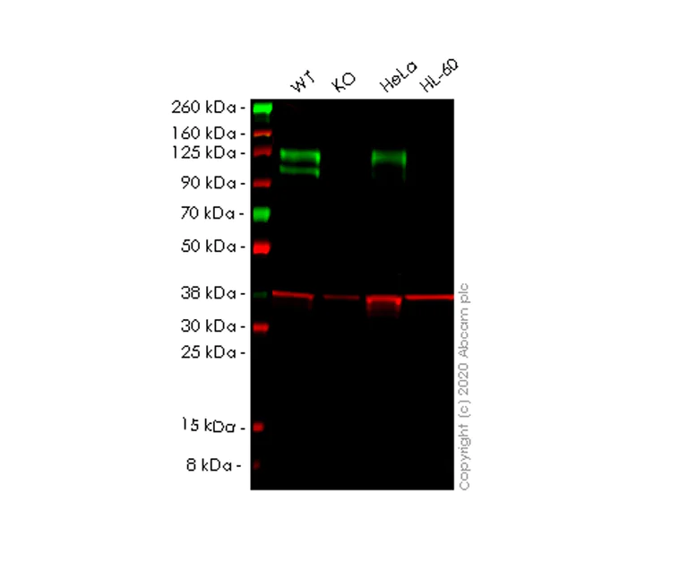 Western blot - Human NCSTN (Nicastrin) knockout HEK-293T cell line (AB266602)