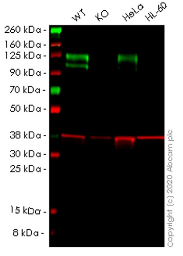 Western blot - Human NCSTN (Nicastrin) knockout HEK-293T cell lysate (AB258061)