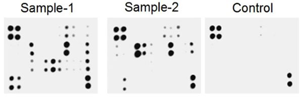 Multiplex Protein Detection - Human Neuro Antibody Array I (Membrane, 20 Targets) (AB211062)