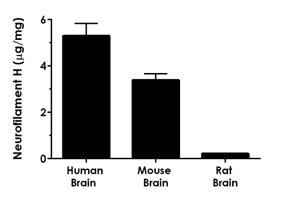 Sandwich ELISA - Human Neurofilament H ELISA Kit (200 kDa Neurofilament protein) (AB272199)
